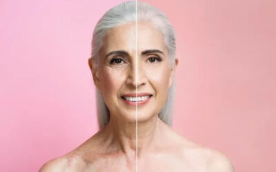 Quanto custa o lifting facial?